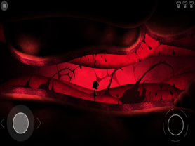 Nightmare : Malaria 1